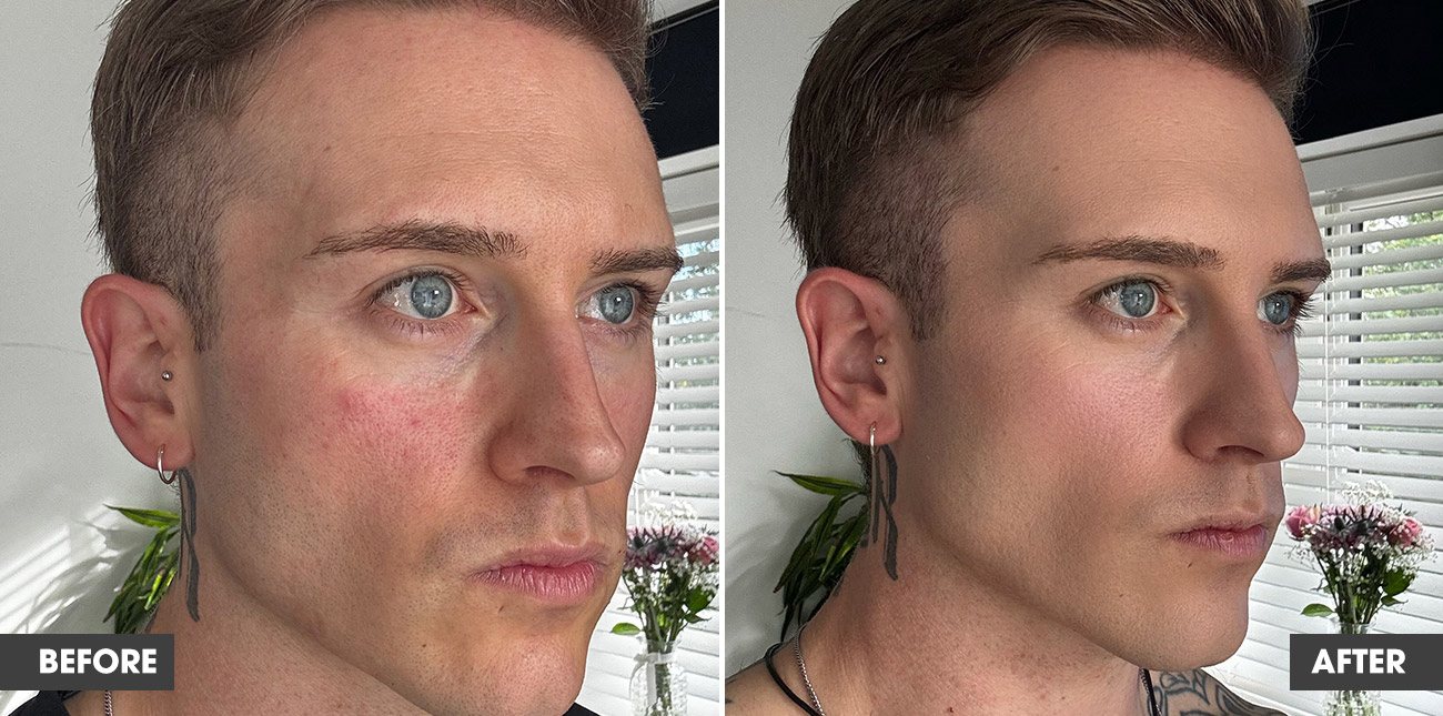 Real customer result 1: before and after