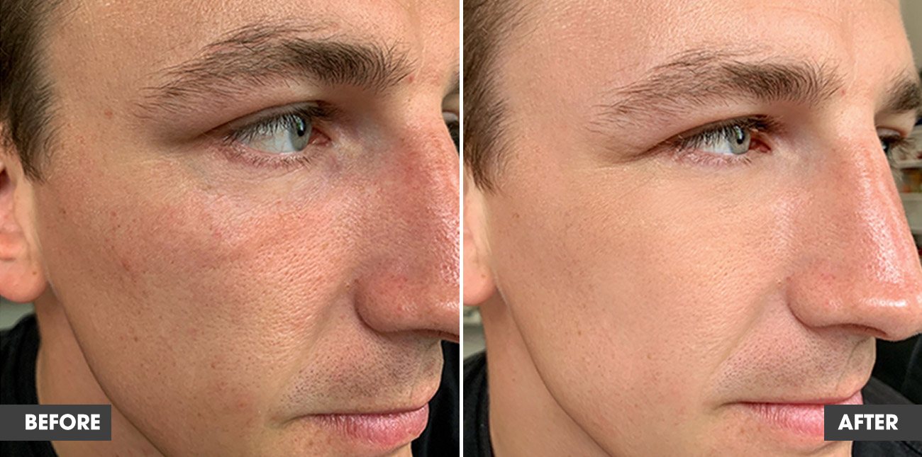 Real customer result 4: before and after
