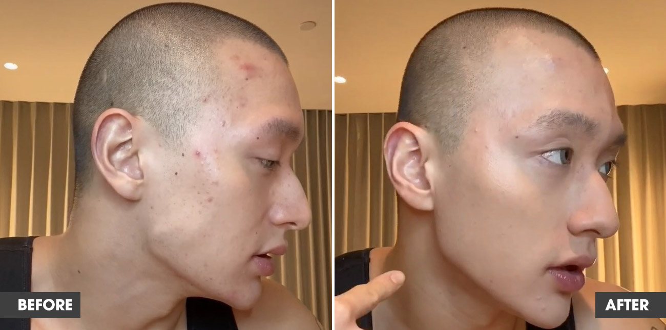 Real customer result 5: before and after