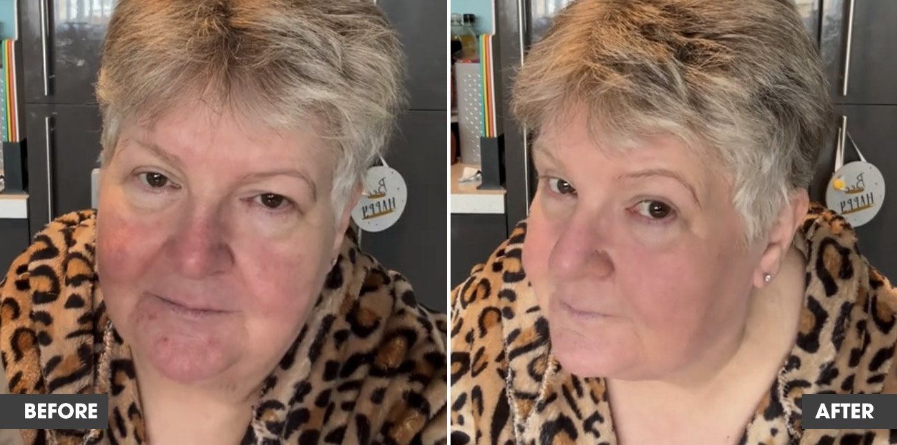 Real customer result 7: before and after