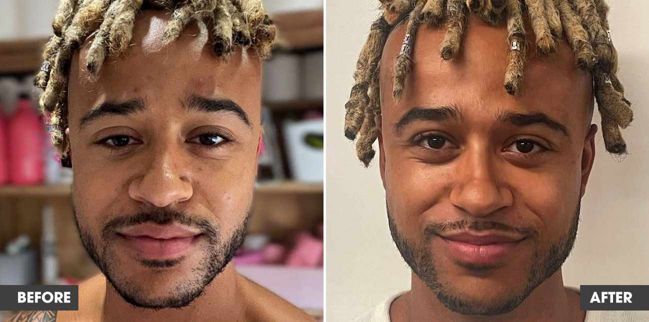 Real customer result 8: before and after